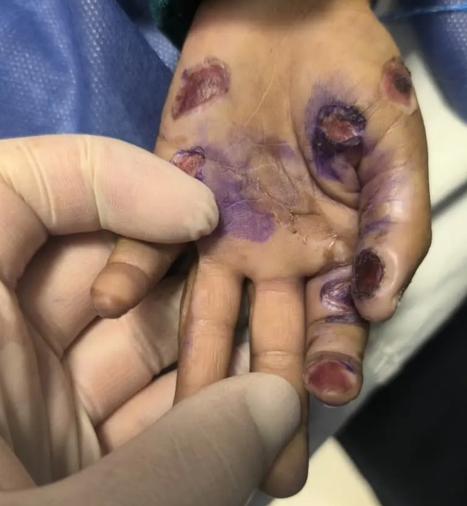 کودک آزاری در هرمزگان