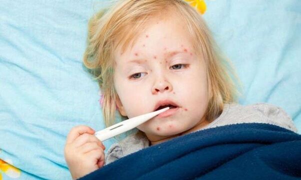 جهان در معرض یک بیماری قدیمی اما فراموش شده؛ هشدار جدی سازمان بهداشت جهانی