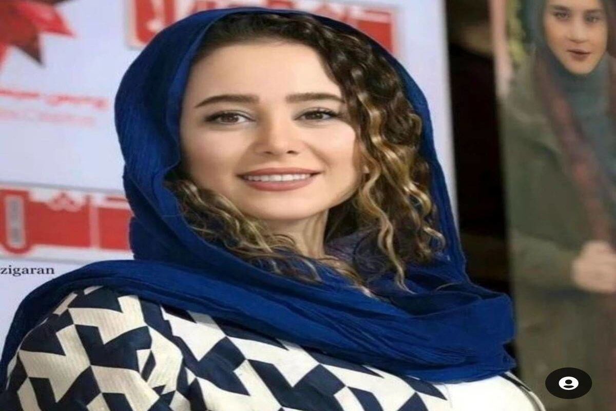 عکس قدیمی الناز حبیبی عمل‌های زیبایی‌اش را لو داد /این مقدار تغییر باور‌کردنی نیست ! +عکس