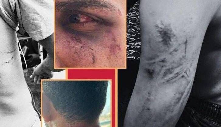 حمله به گردشگران در اوپرت با سلاح گرم و شوکر/ ماجرا چه بود؟ + عکس