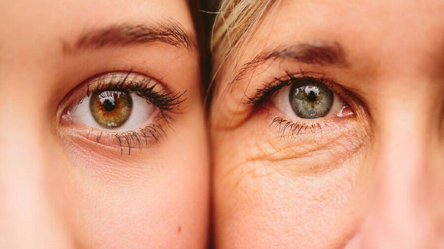 چروک‌های پوست صورت از یک بیماری مرگبار خبر می‌دهند؟