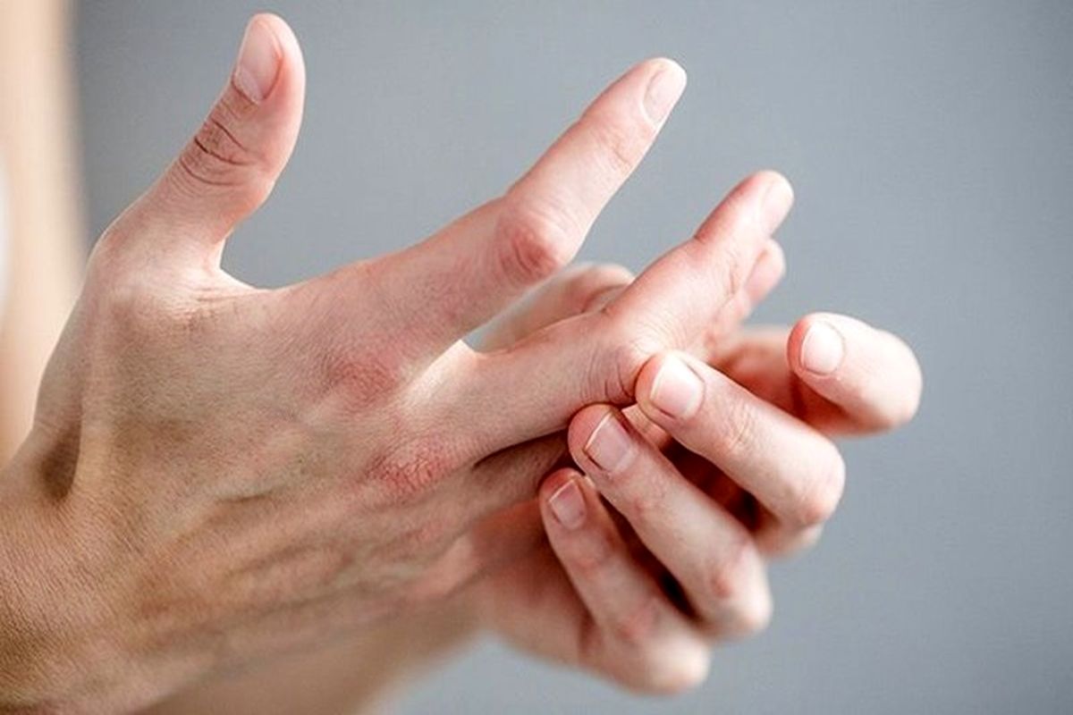 این علائم در انگشتان نشانه دیابت است!