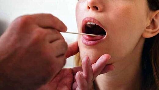 هشدار؛ سوزش زبان نشانه این بیماری خطرناک است!
