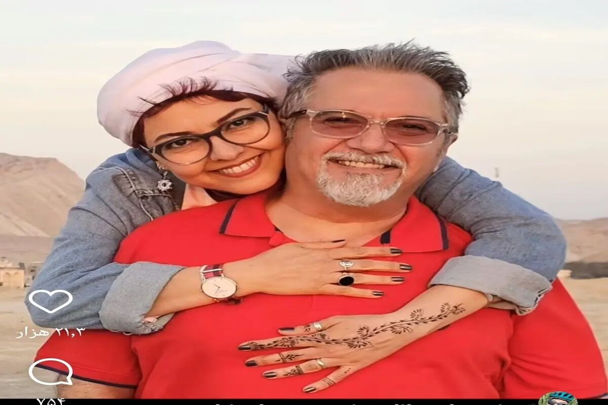  تغییر چهره عجیب آناهیتا همتی بعد از ازدواج دوم
