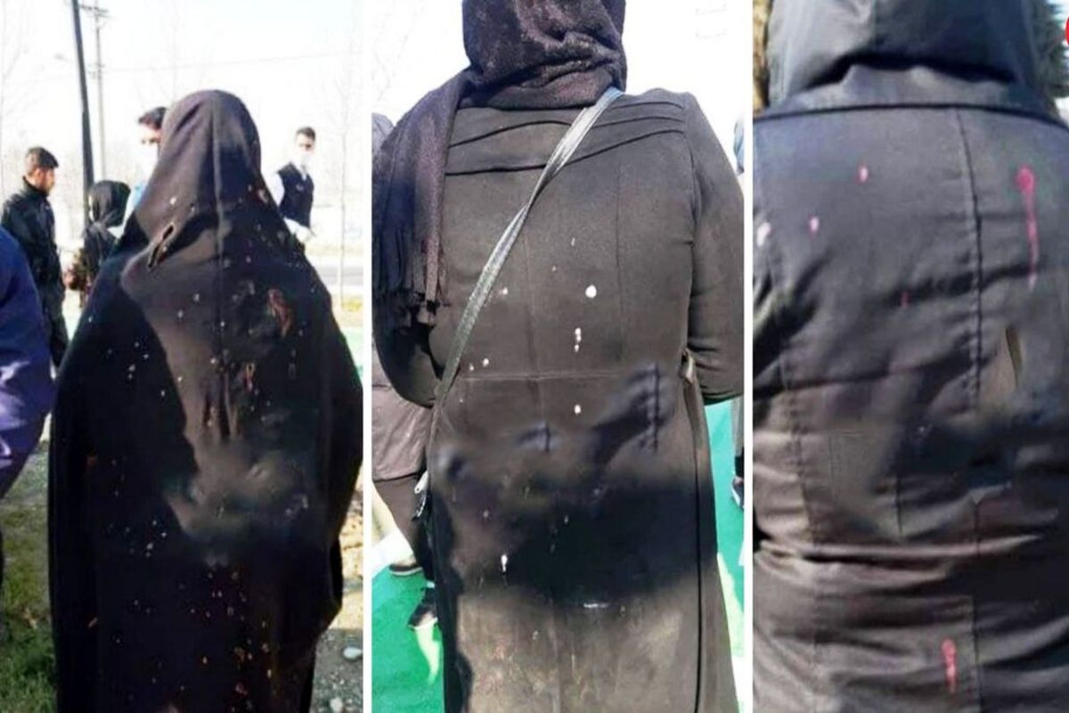 اسیدپاشی هولناک به زنان تهرانی توسط مرد دیوانه/ او چگونه و در کجا به طرف زنان اسید می پاشید؟