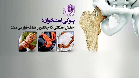 معرفی ویتامین مناسب برای فرار از پوکی استخوان