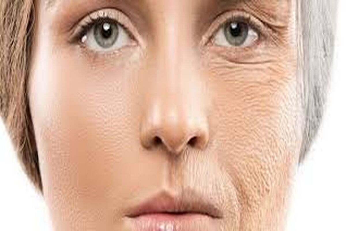 چه غذاهایی پوست شما را پیر می کنند؟