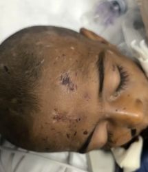 ماجرای مرگ کودک ۴ساله بر اثر کودک آزاری/ خانواده ادعا کرده‌اند؛ کودک از بالای درخت افتاده/عکس‌های +18