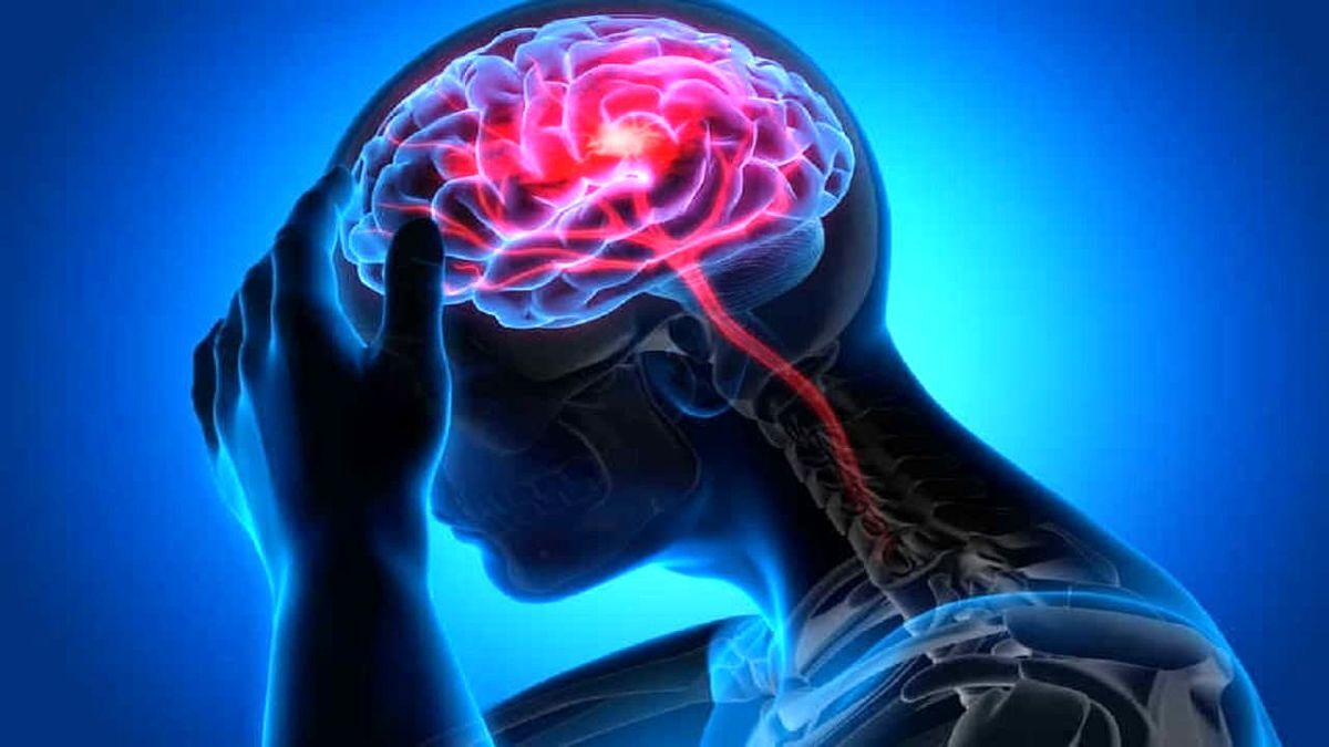 کمبود این ویتامین باعث سکته مغزی می‌شود