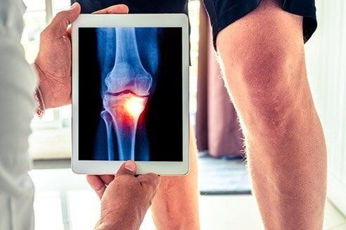 ۸ علت ابتلا به پوکی استخوان را بشناسید