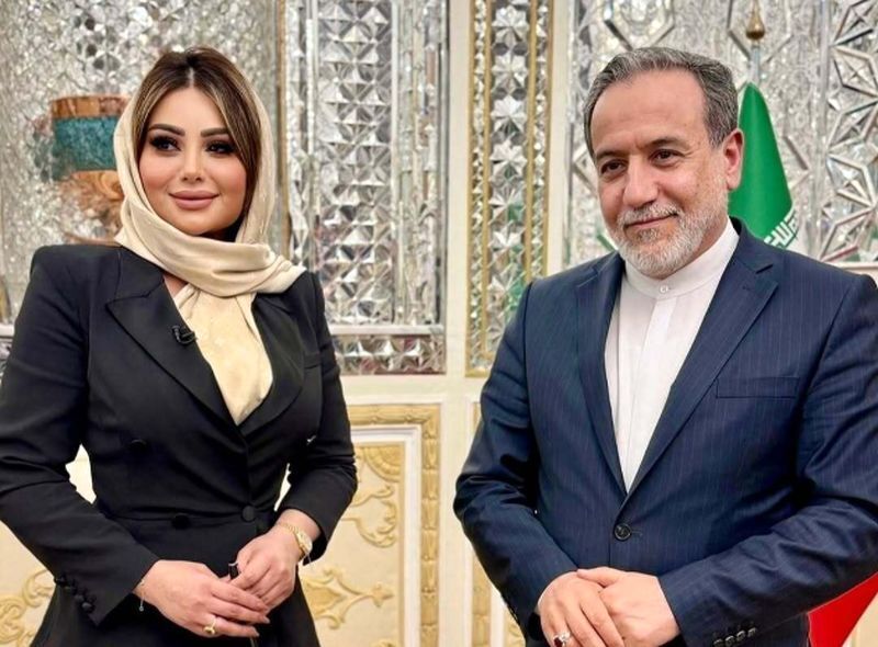 تغییر چهره مجری زن فلسطینی بعد از عمل زیبایی