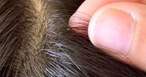 راهکار نابودی شپش سر کودک