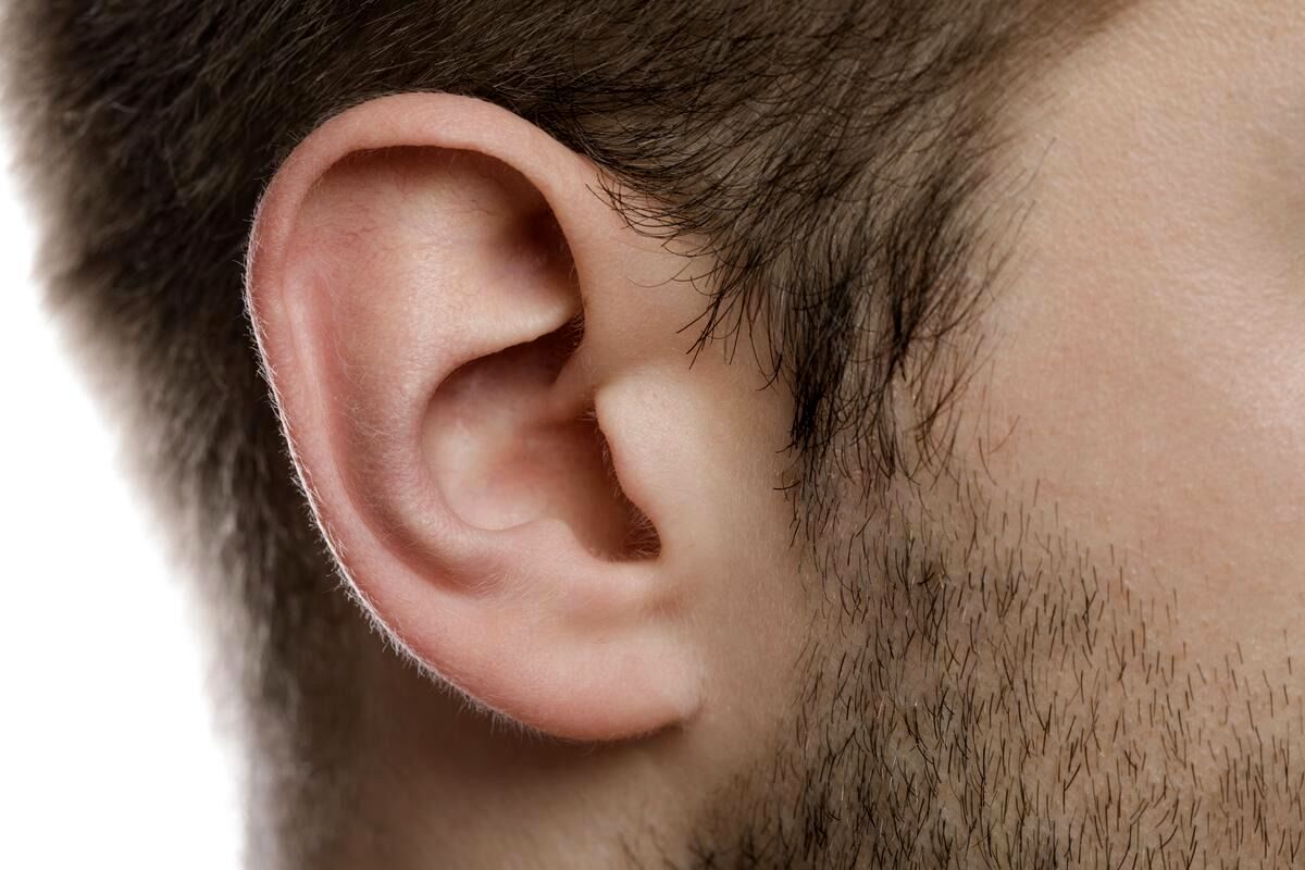 هشدار، مو روی لاله گوش نشانه  این بیماری است!
