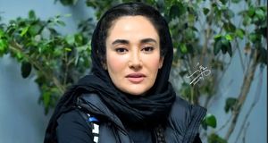 تغییر چهره عجیب و ناگهانیِ بهاره افشاری!/ عکس