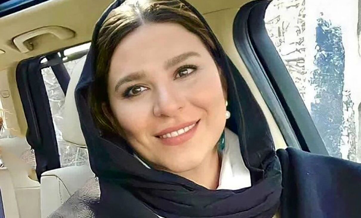 تغییر چهره جالب سحر دولتشاهی بعد از زایمانش +عکس