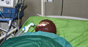 زن دیوانه که روی مرد جوان و دختر ۱۱ ساله‌اش اسید پاشی کرد