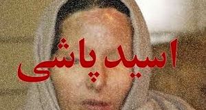 اسیدپاشی وحشتناک روی خواهر بخاطر ارثیه شیرین