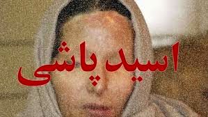 اسیدپاشی وحشتناک روی خواهر بخاطر ارثیه شیرین