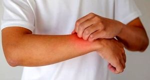 به این دلیل مهم نگران گزگز دست تان باشید