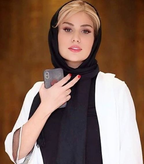تغییر چهره رز رضوی بعد از عمل زیبایی/ عکس