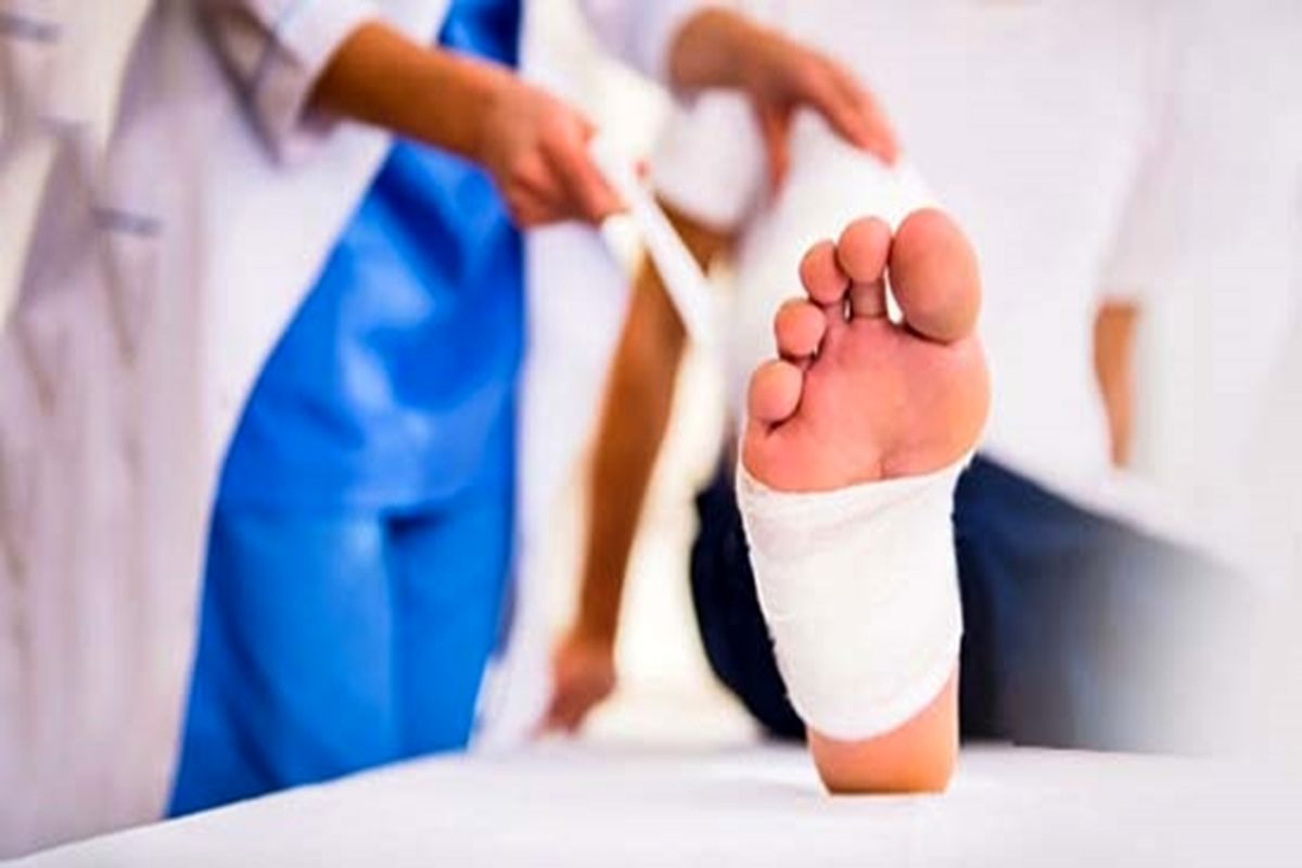 نکات کاربردی برای پیشگیری از زخم پای دیابتی