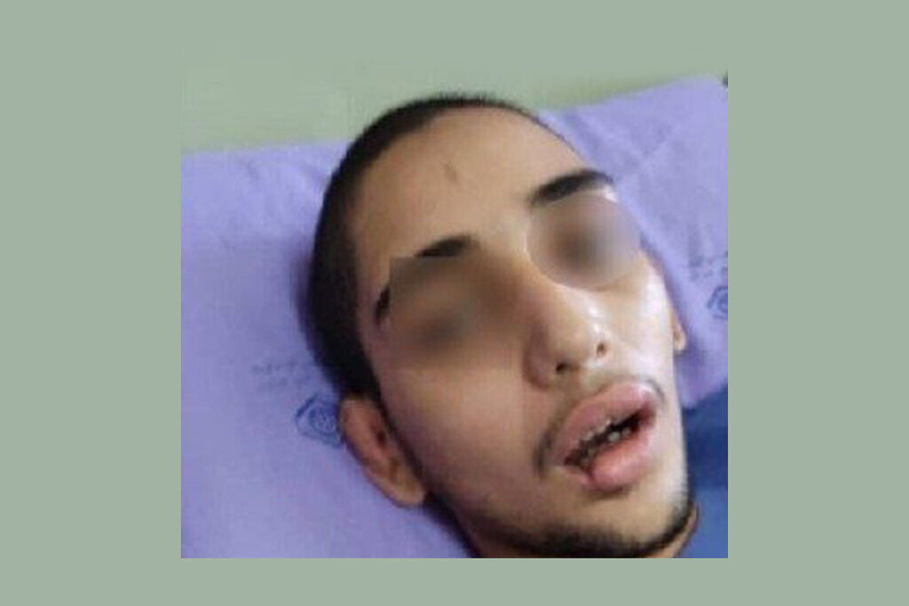 تصاویر (۱۸+) / شکنجه هولناک یک ناتوان ذهنی در مرکز نگهداری