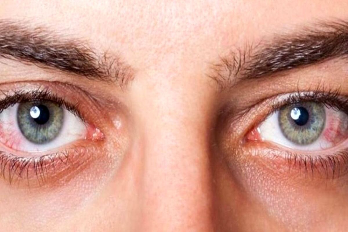 آیا می‌توان مشکلات سلامتی را از طریق چشم‌ها شناسایی کرد؟