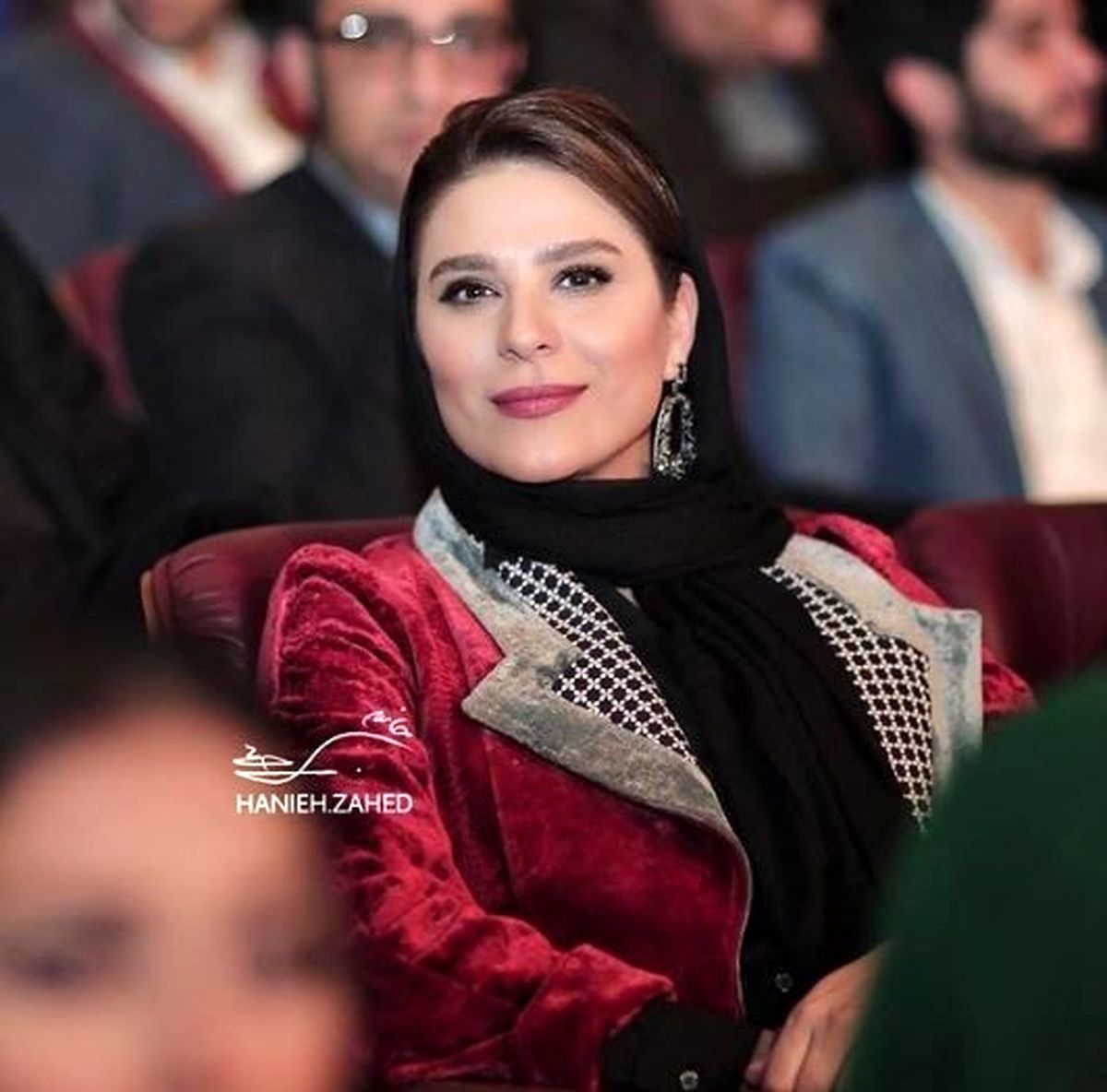 چهره واقعی سحر دولتشاهی را قبل از عمل زیبایی ببینید/ عکس