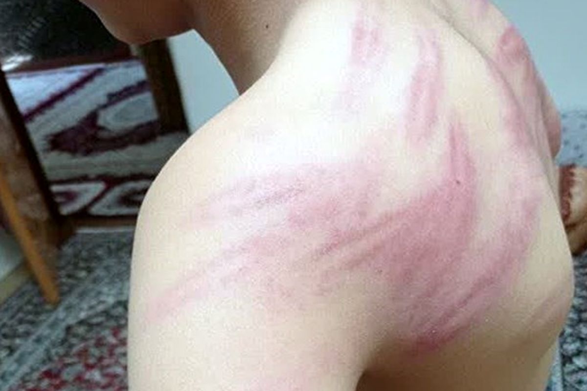 ضرب و شتم وحشیانه یک دانش‌آموزان در سنندج