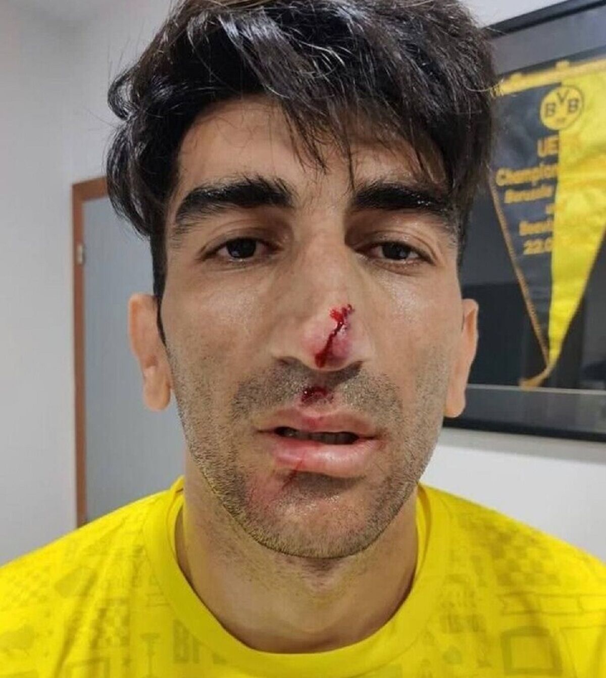 جزییات ماجرای حمله به علیرضا بیرانوند در مسیر بازگشت به تهران