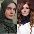 متین ستوده قبل و بعد از تزریقات زیبایی را ببینید/ تصاویر