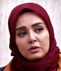 شیرین «نون‌ خ» هم تزریقات زیبایی انجان داد!/ عکس