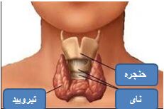 دلیل کم کاری تیروئید چیست؟